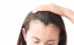 <b>女性脱发怎么办？烫染拉夹做造型，头发养护要注意</b>