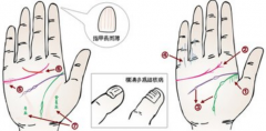 手掌上的健康密码掌纹看病，4种常见疾病的手相特征