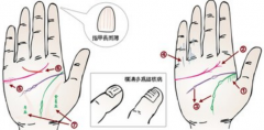 掌纹诊病花斑掌代表什么，与个人身体状况有关，具体情况是这样的