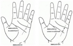 实用掌纹诊病技术，7种掌纹看出身体隐藏的秘密