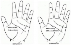 掌纹诊病有科学依据吗，不是迷信歪学，有科学依据