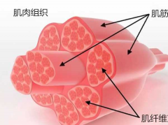 什么是肌痛纤维综合症 这个肌痛纤维症发病的原因